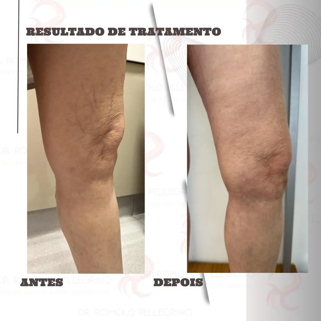 Antes e Depois 1.pptx (1)