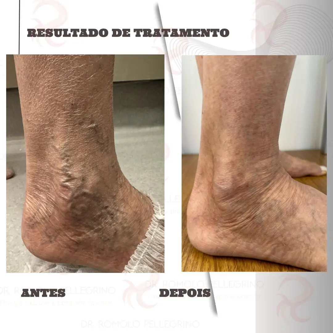 Antes e Depois 1.pptx