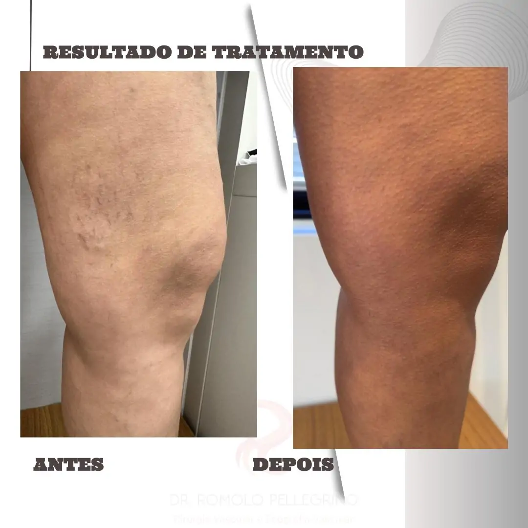 Antes e Depois 3.pptx (1)